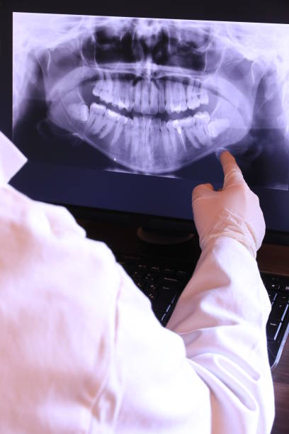 Best Emergency Dentist for Knocked-Out Tooth in Cross Plains, TX